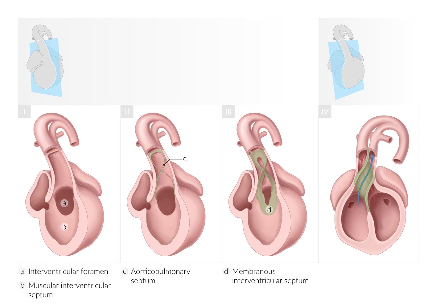 Ventricular septation