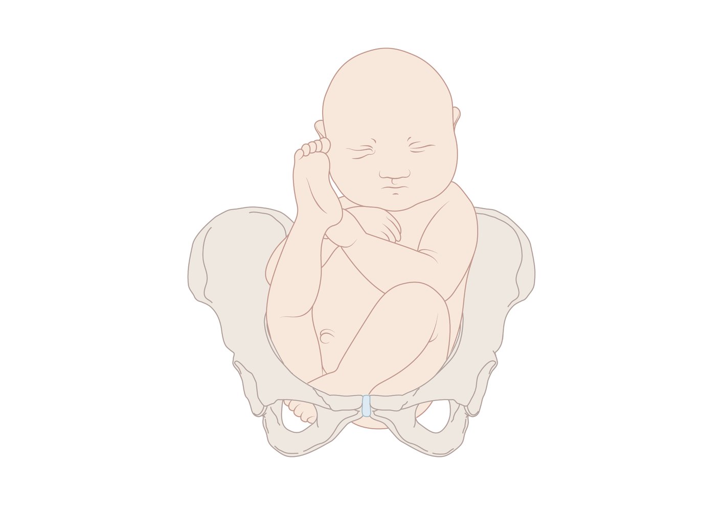 Types of breech presentation: incomplete breech