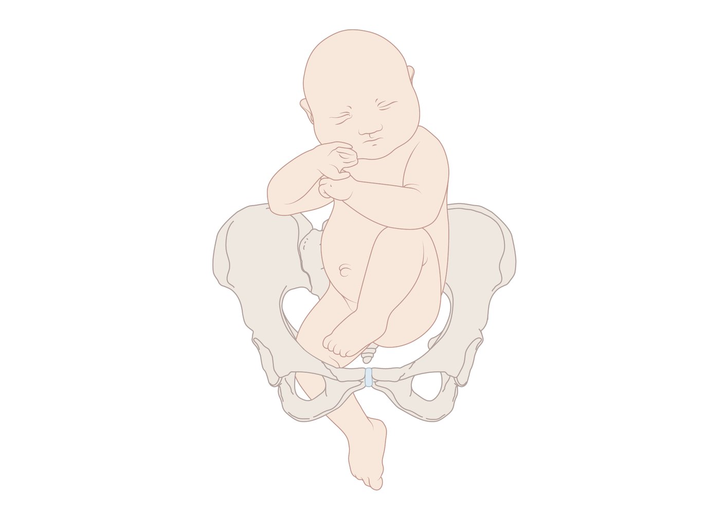Types of breech presentation: Single Footling breech