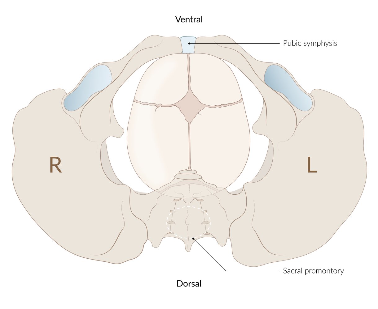 Occiput posterior position