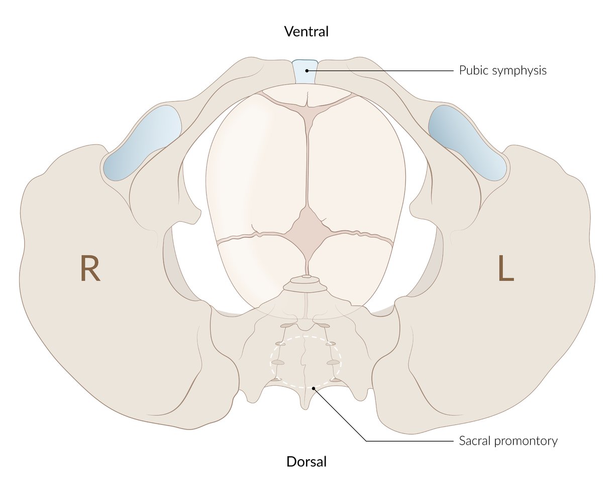 Occiput anterior position