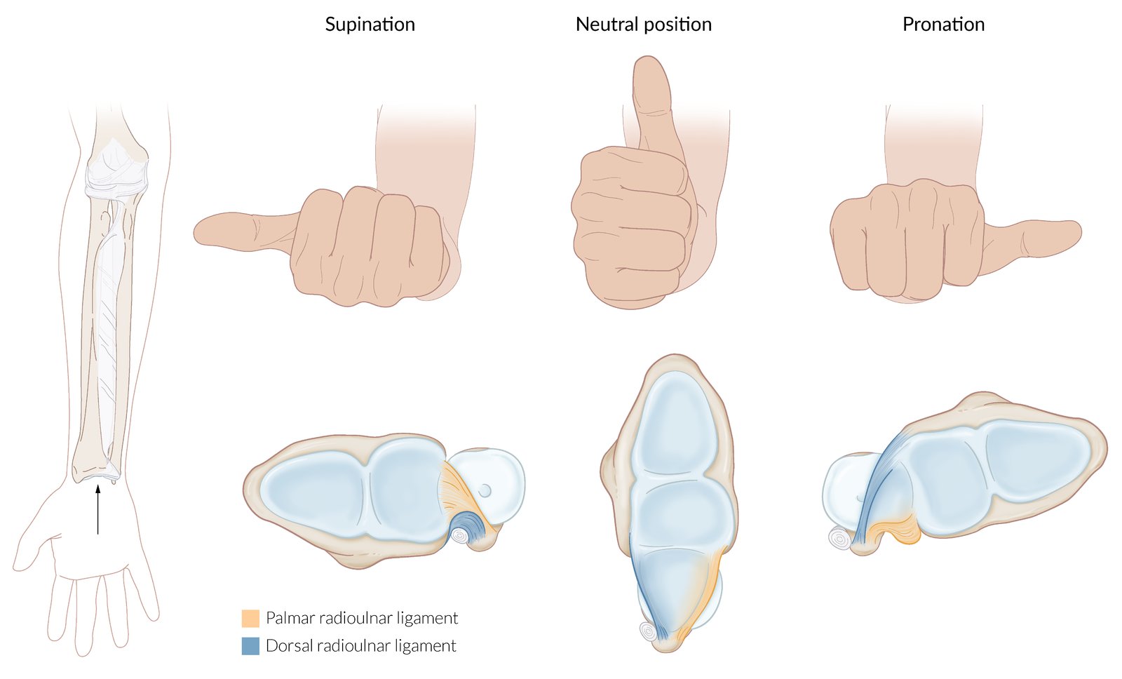 Distal radioulnar joint