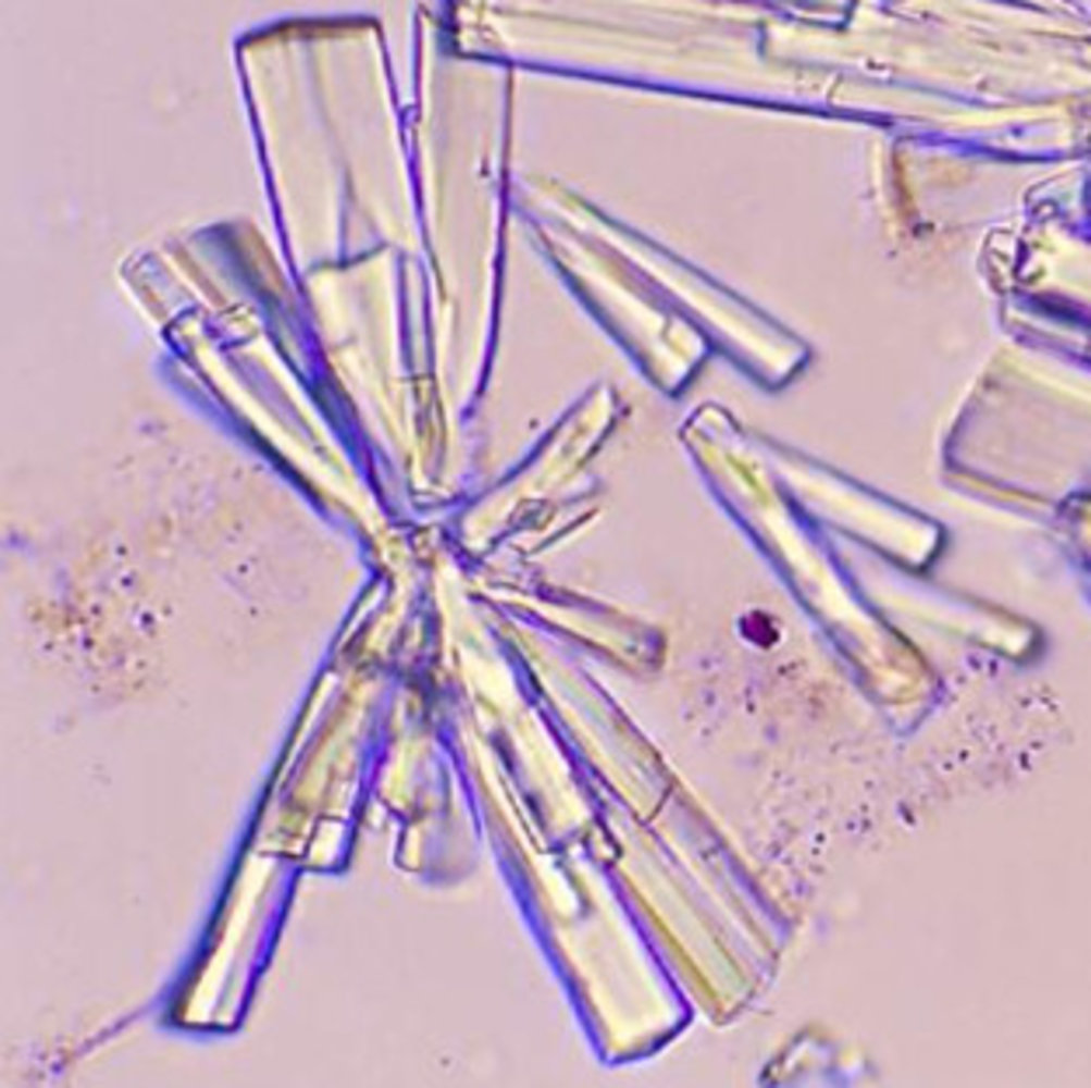 Calcium phosphate crystals