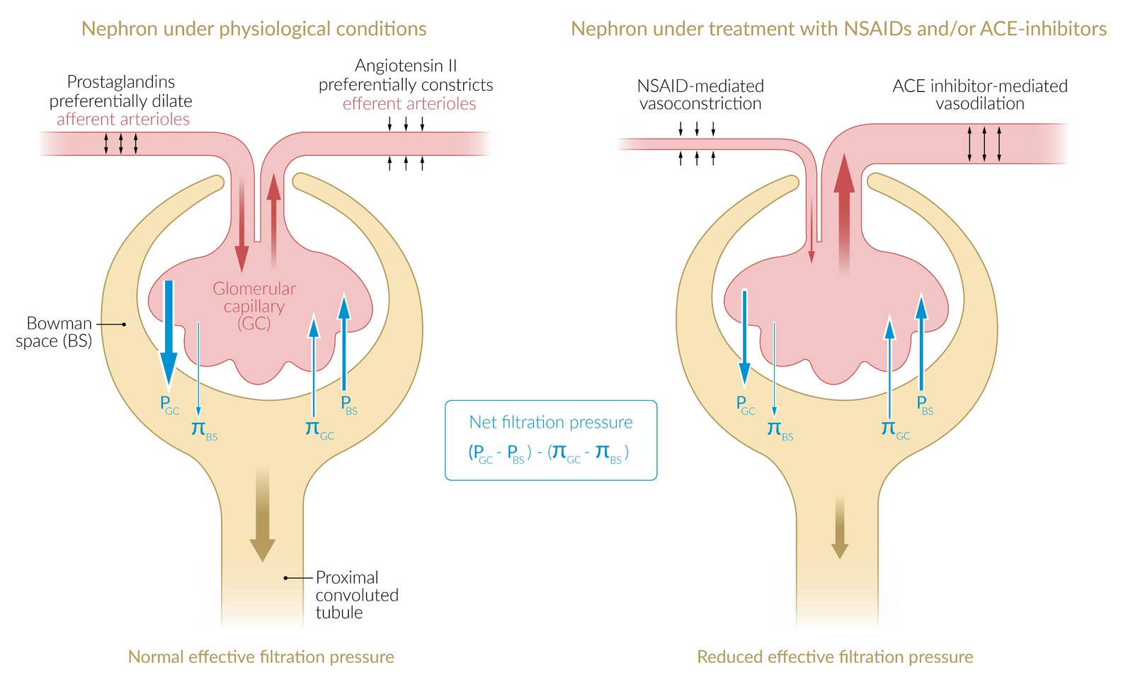 Effects of NSAIDs and ACEIs on renal filtration