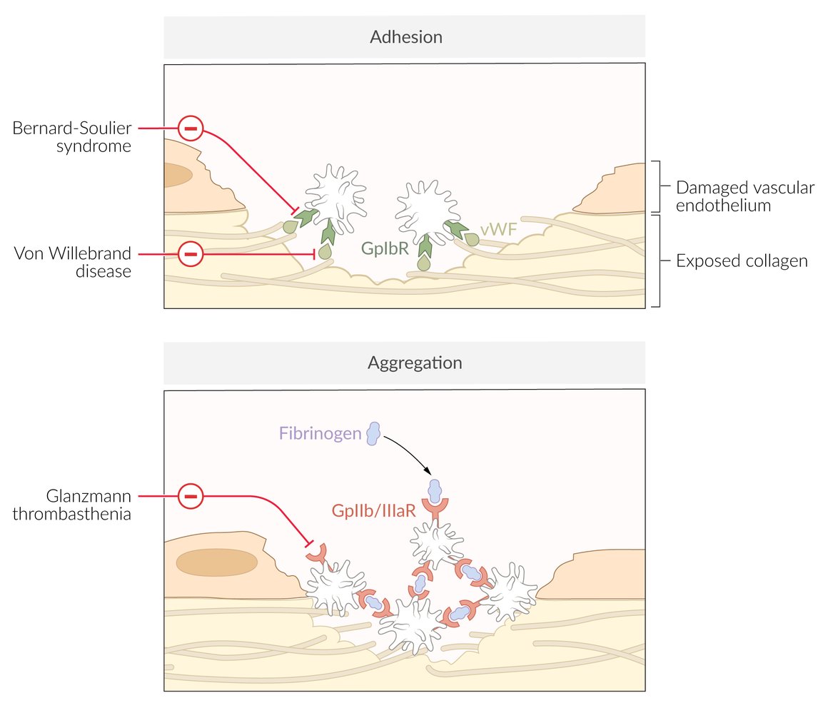 Congenital disorders affecting primary hemostasis