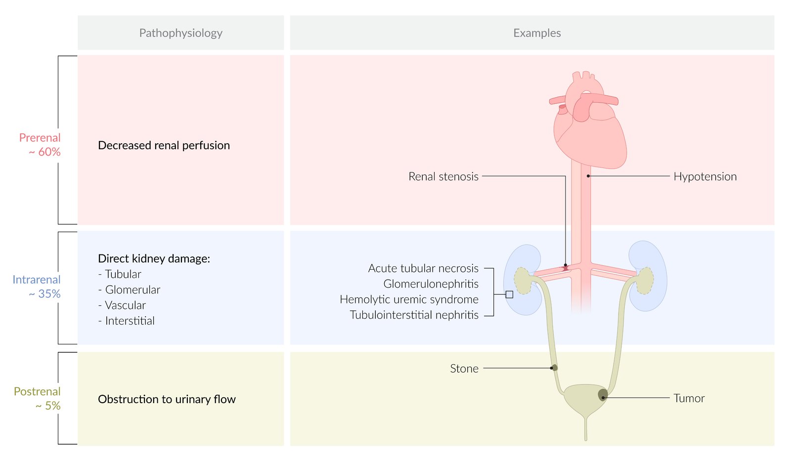 Etiology of acute kidney injury