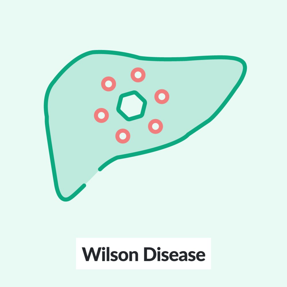 Chalk Talk: Wilson Disease