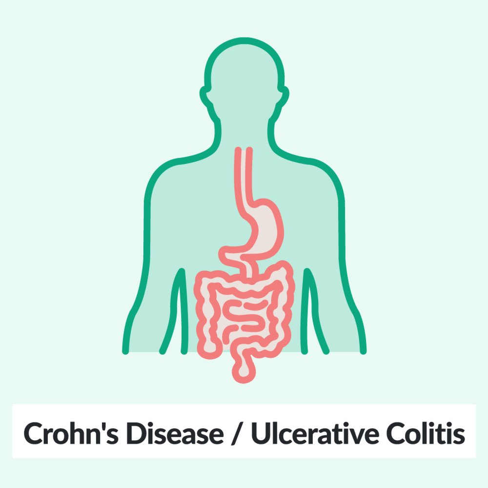 Chalk Talk: Crohn's disease and ulcerative colitis