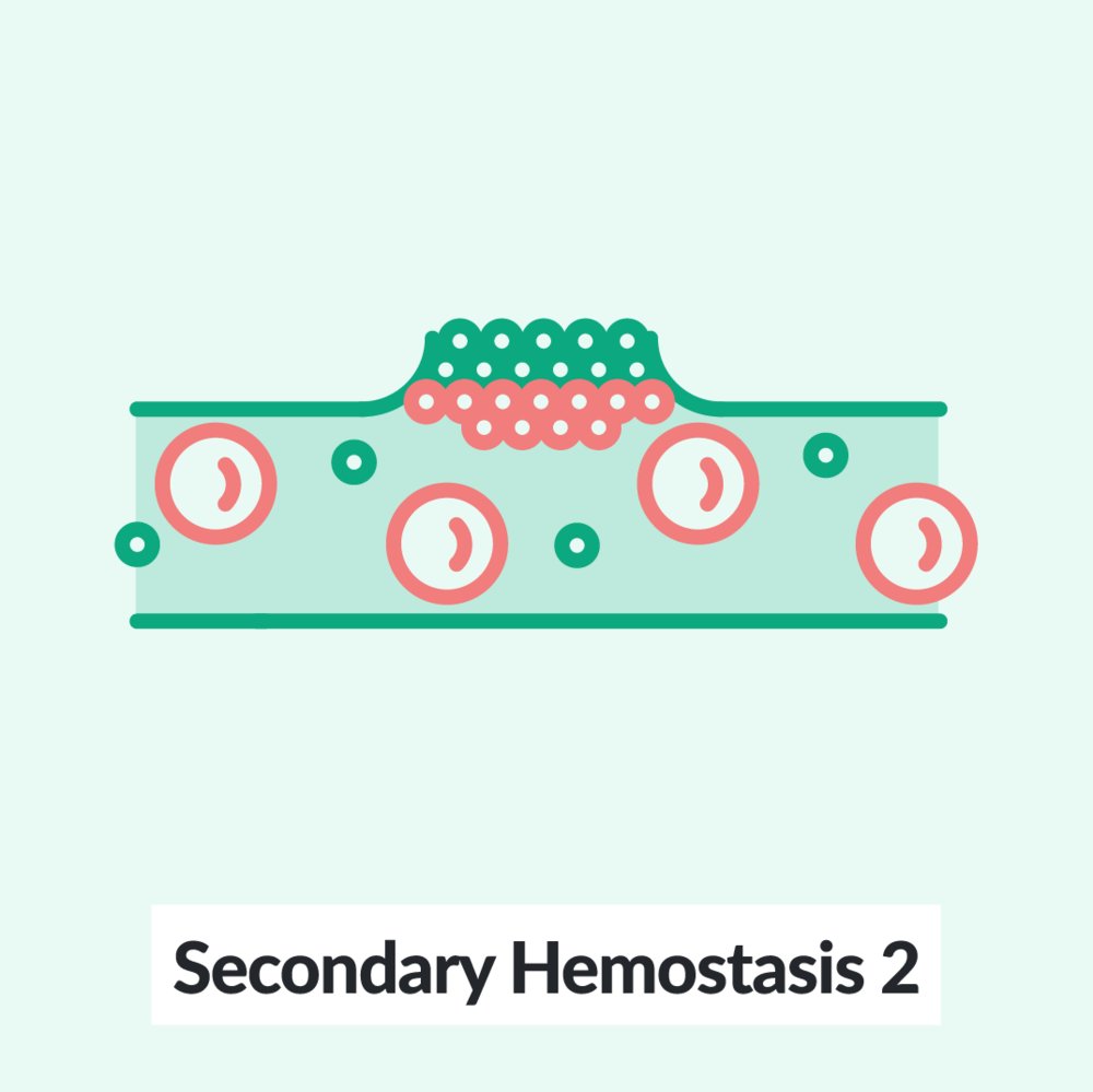Chalk Talk: Secondary hemostasis 2