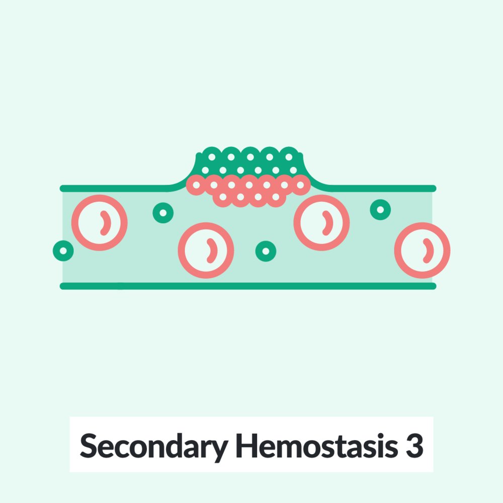 Chalk Talk: Secondary hemostasis 3