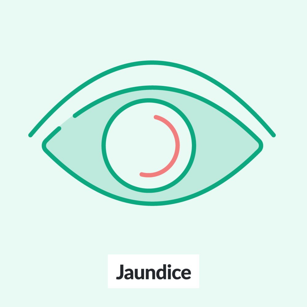 Chalk Talk: Jaundice