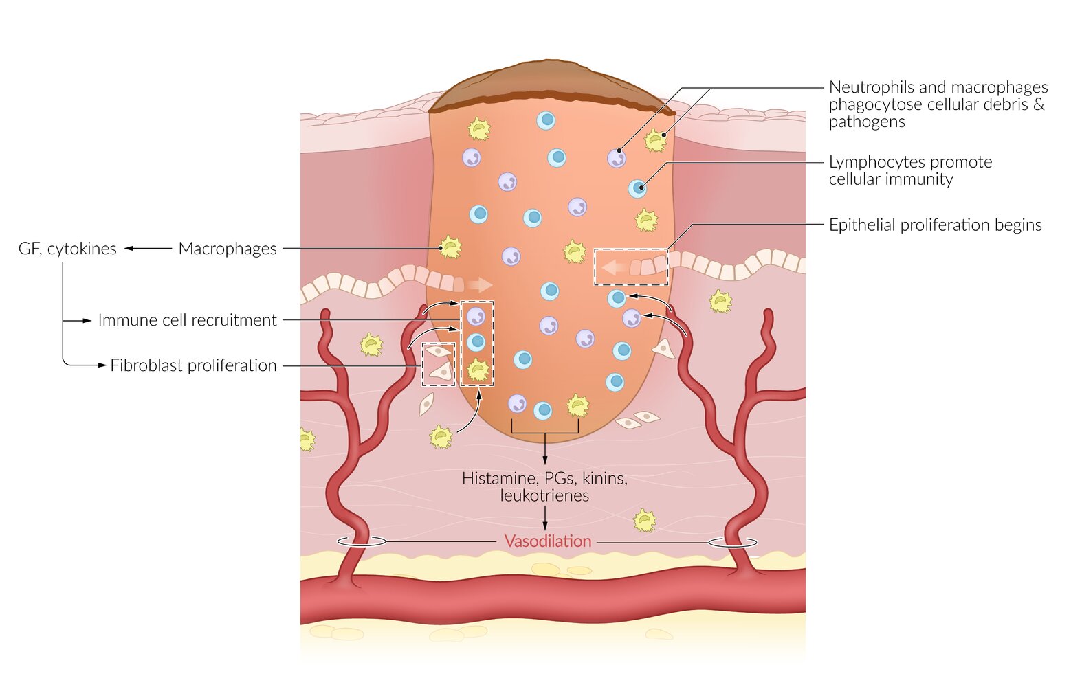 Resorptive phase of wound healing