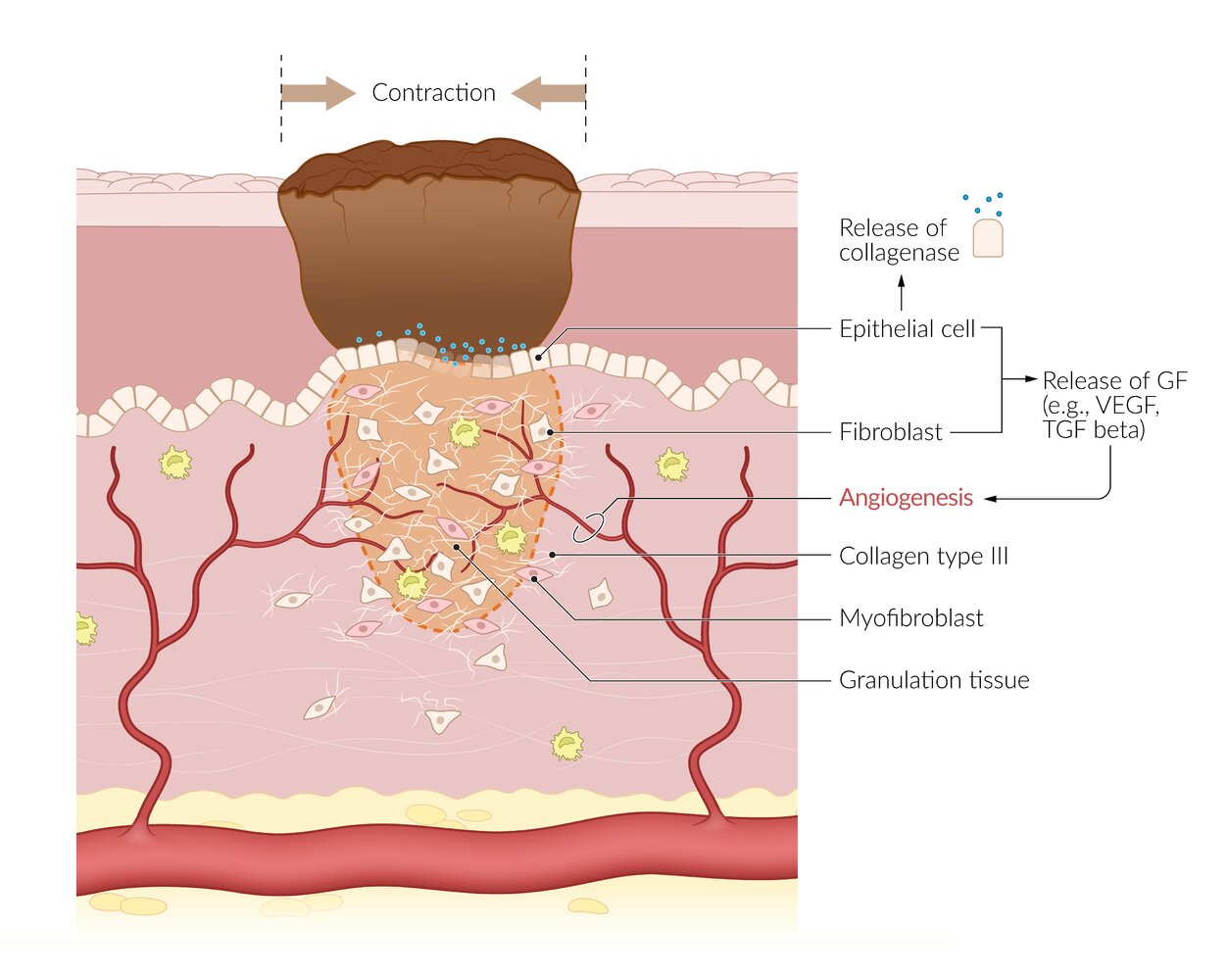 Proliferative phase of wound healing