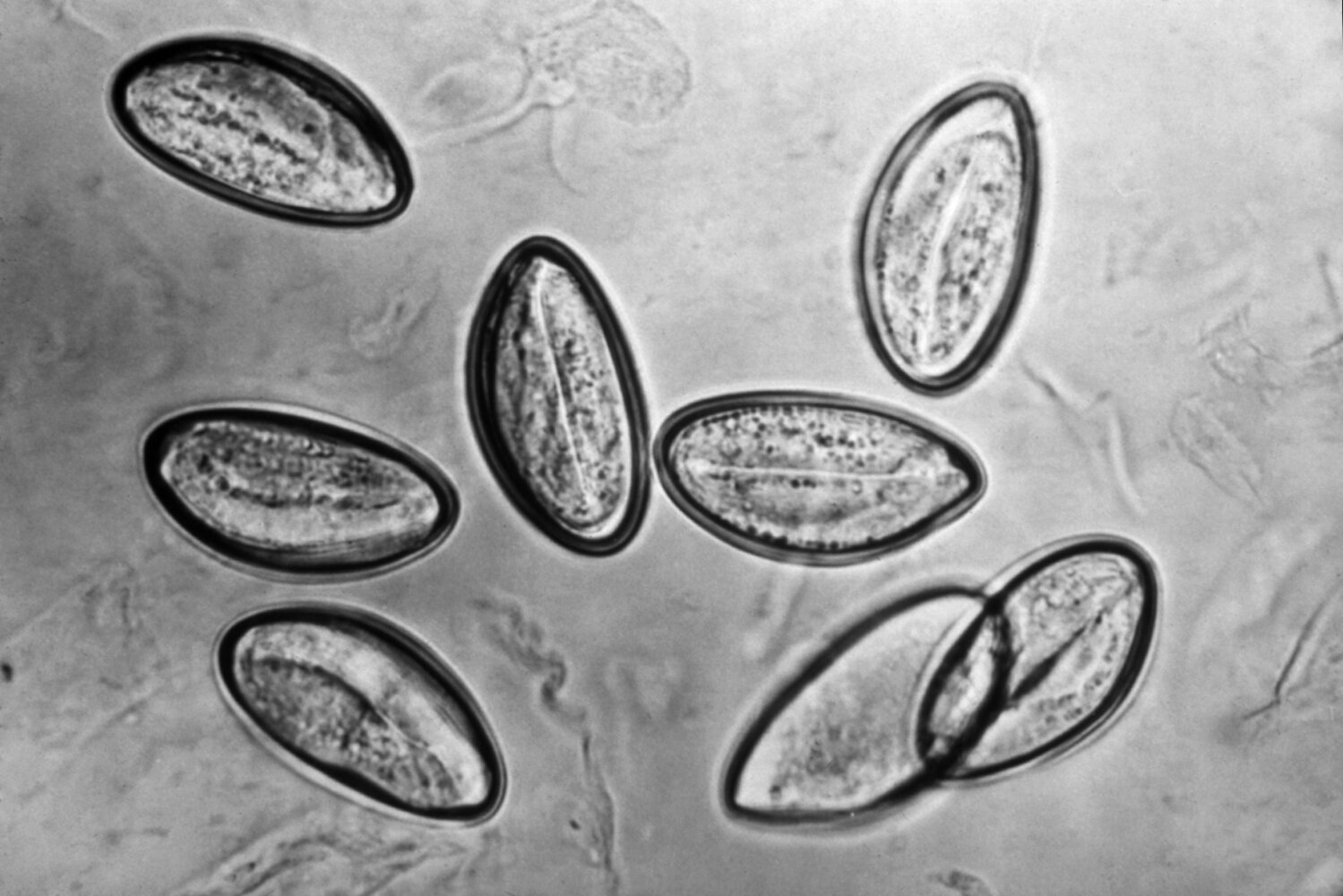 Enterobius vermicularis eggs