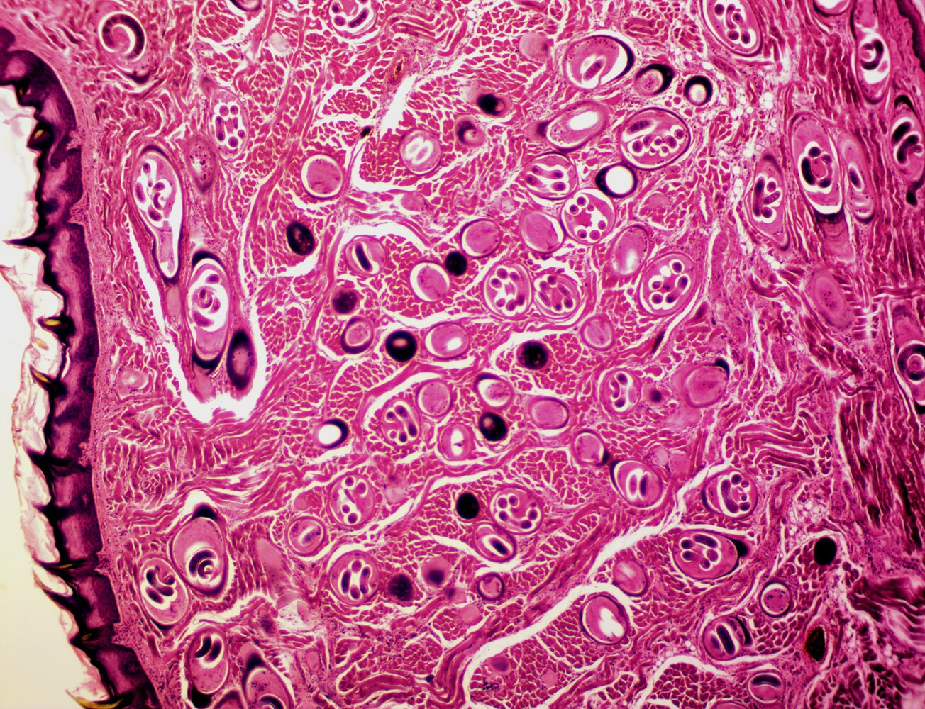Trichinella spiralis