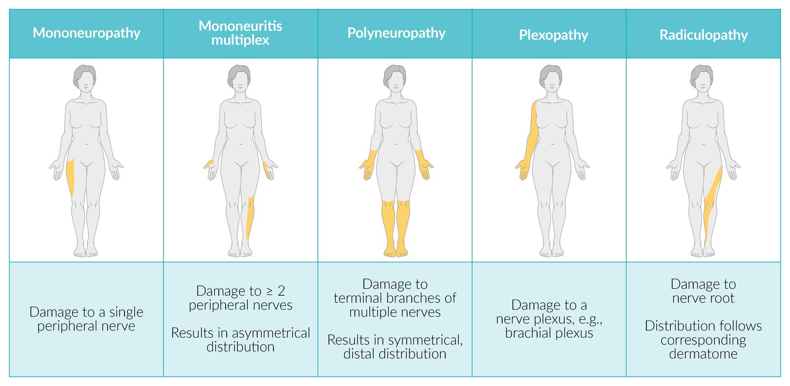 Peripheral neuropathy