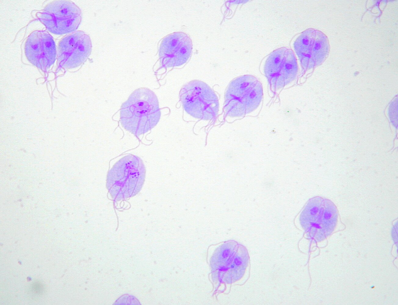 Giardia lamblia