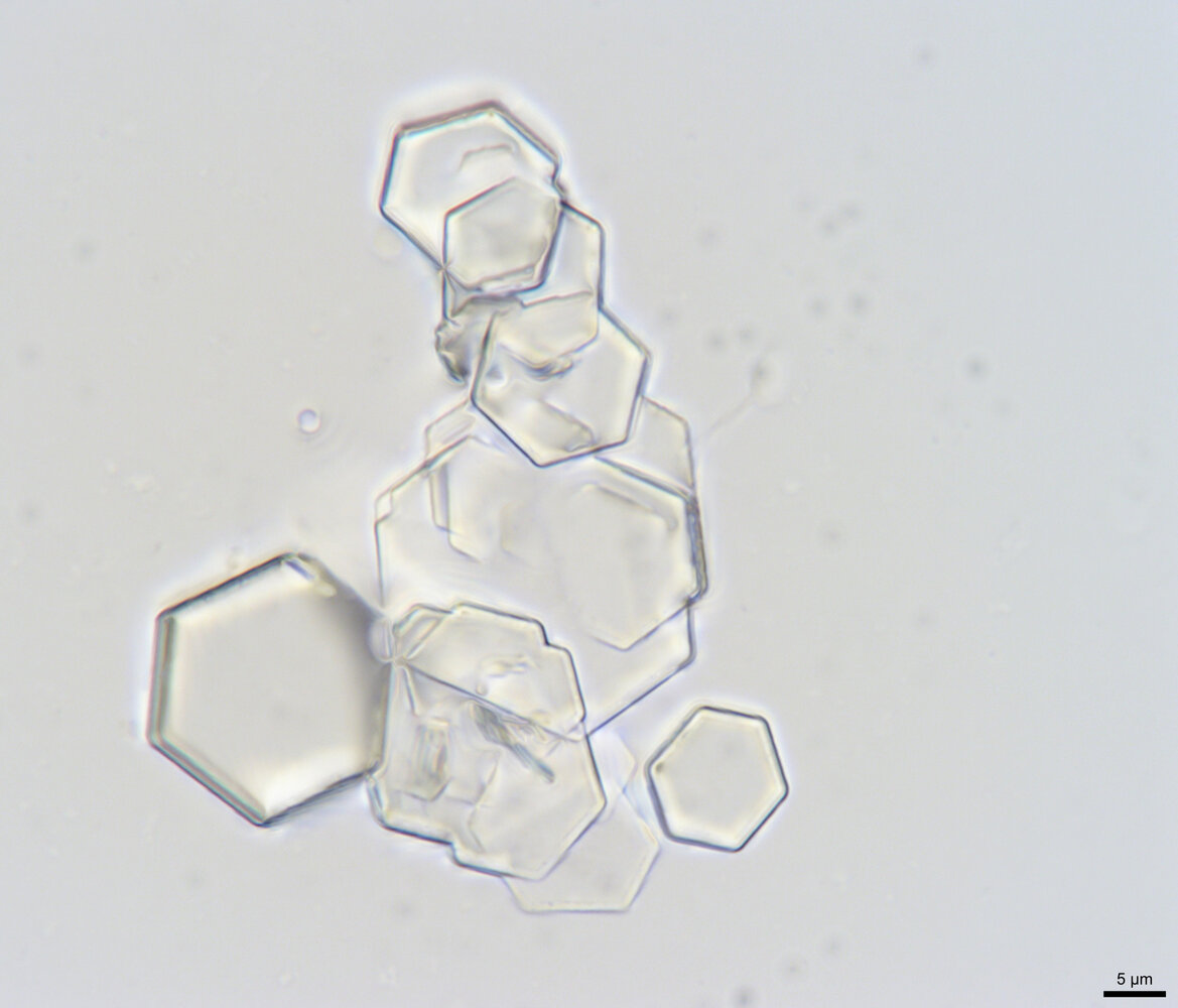 Cystine crystals