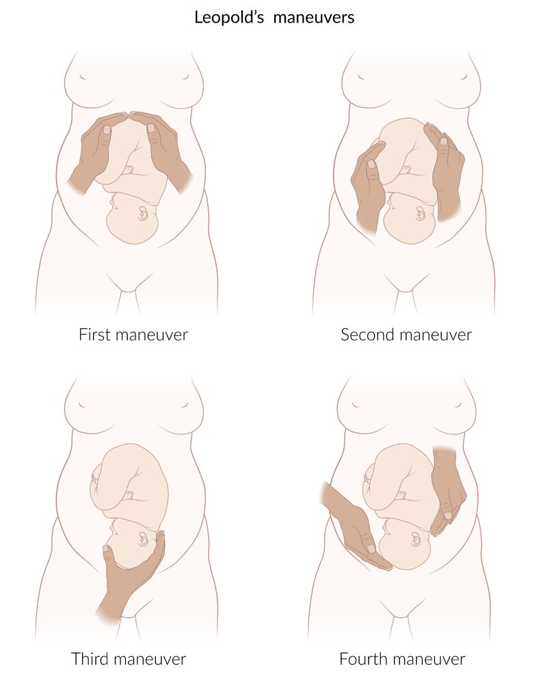 Leopold's maneuvers