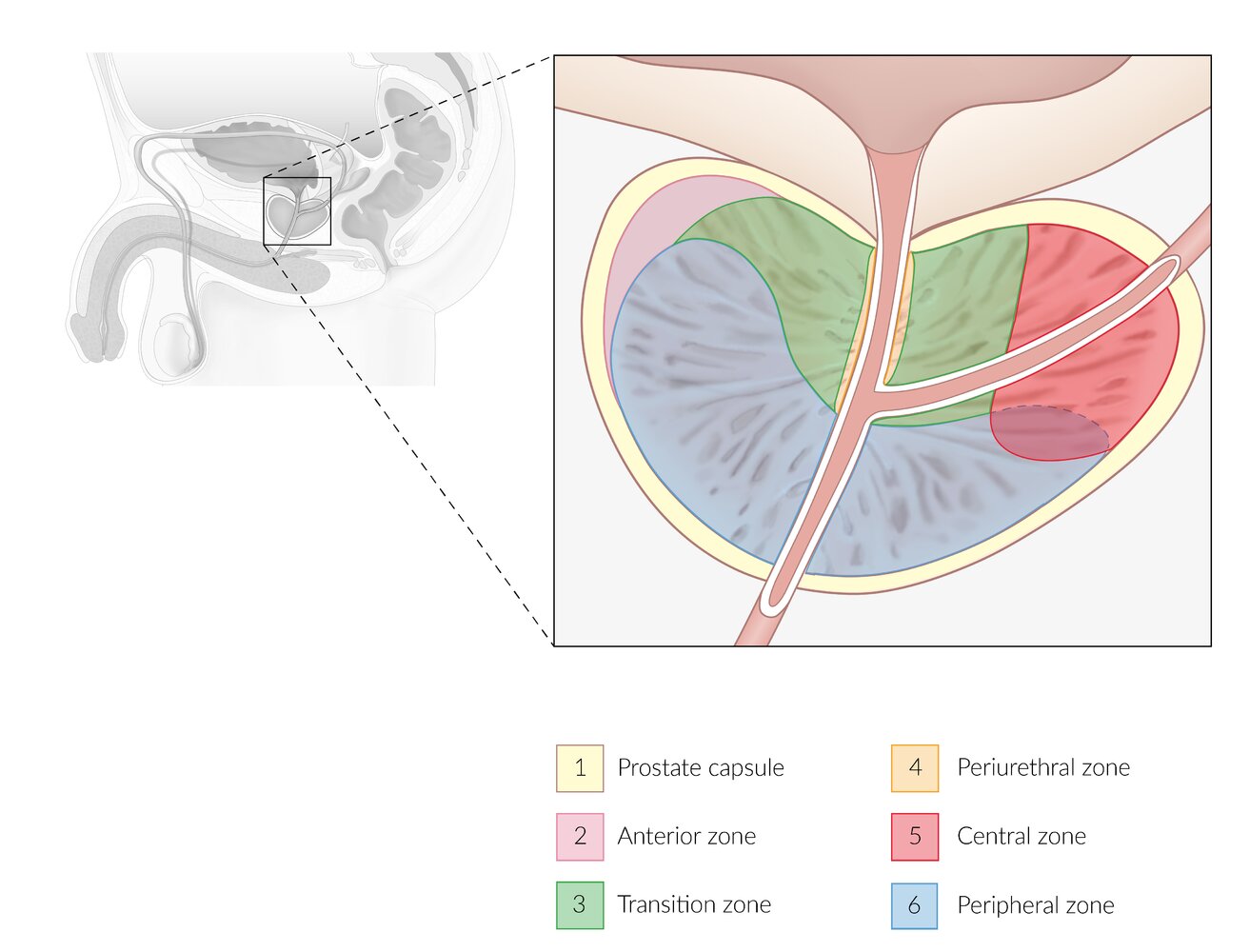 Zones of the prostate