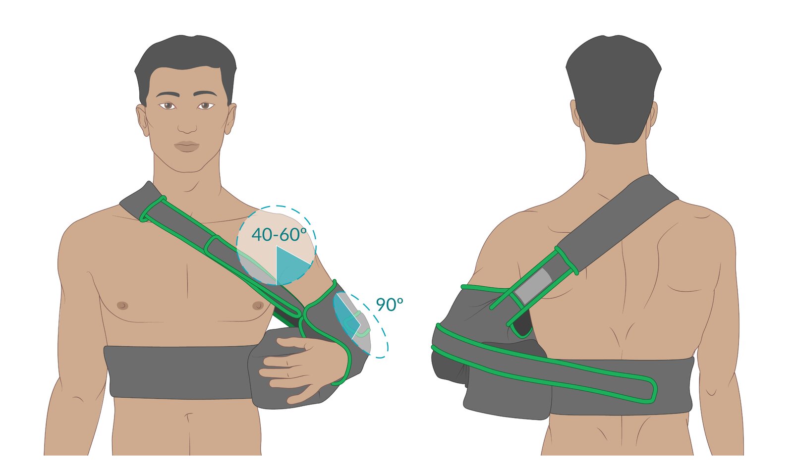 Shoulder abduction sling