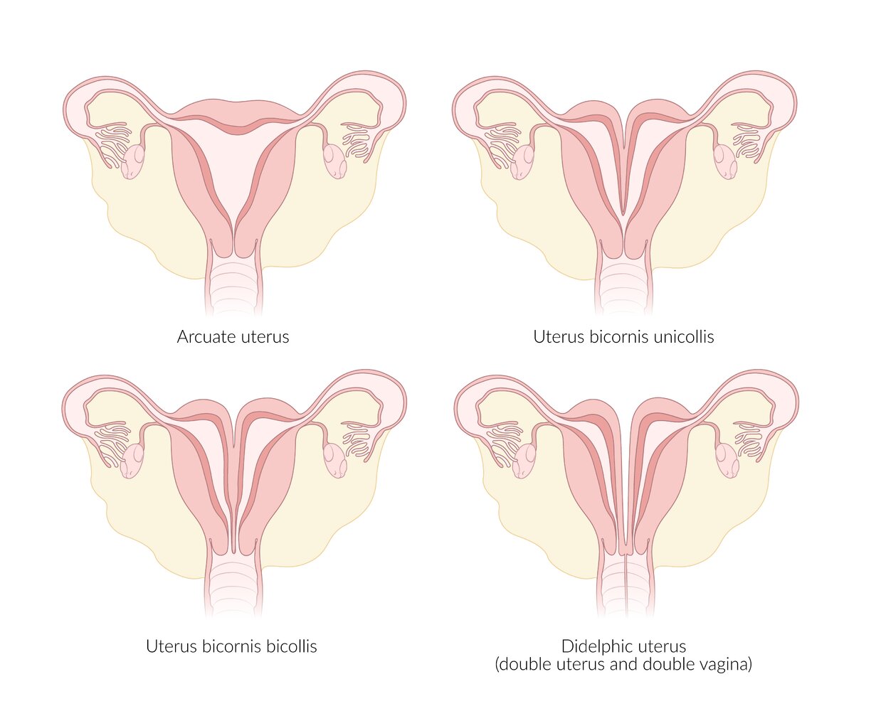 Anomalies of the uterus I