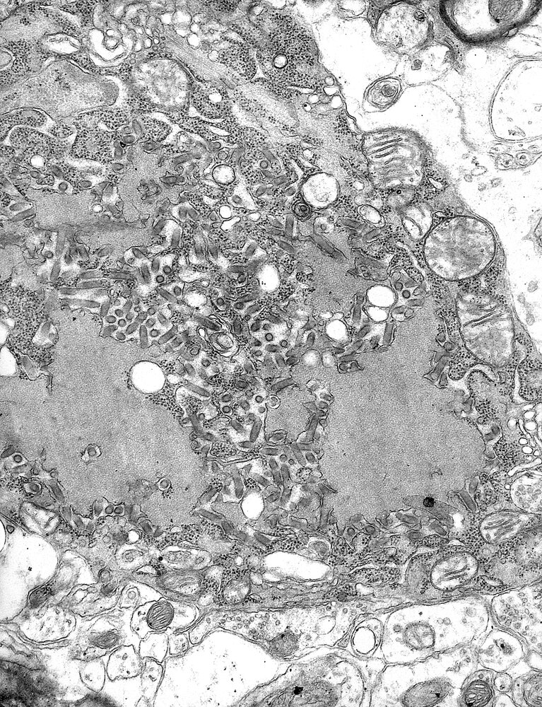 Rabies virus