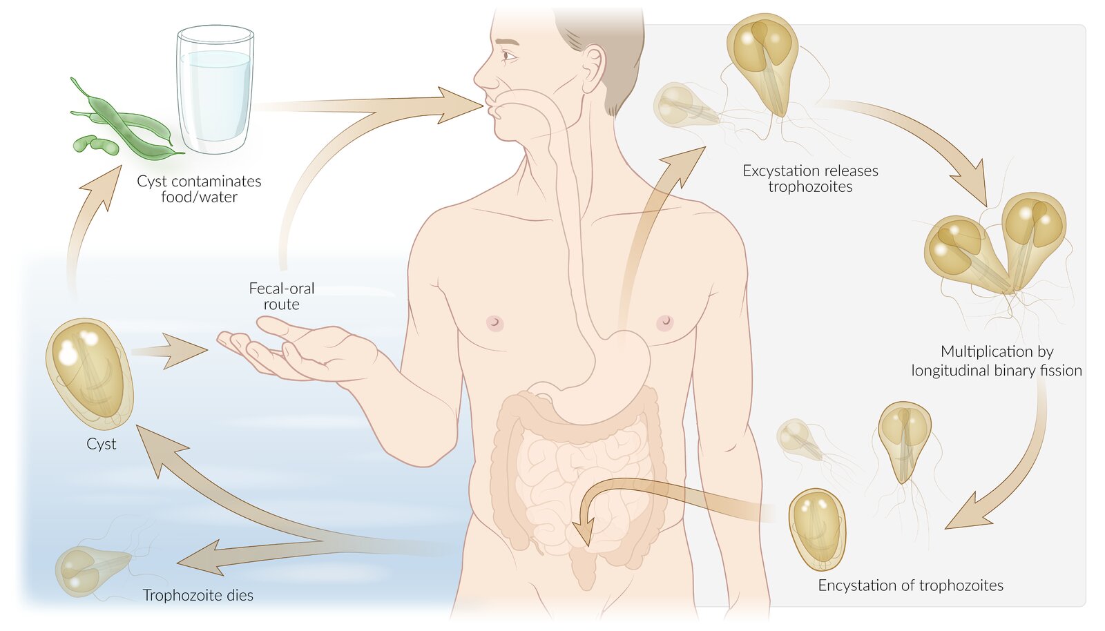 Giardiasis