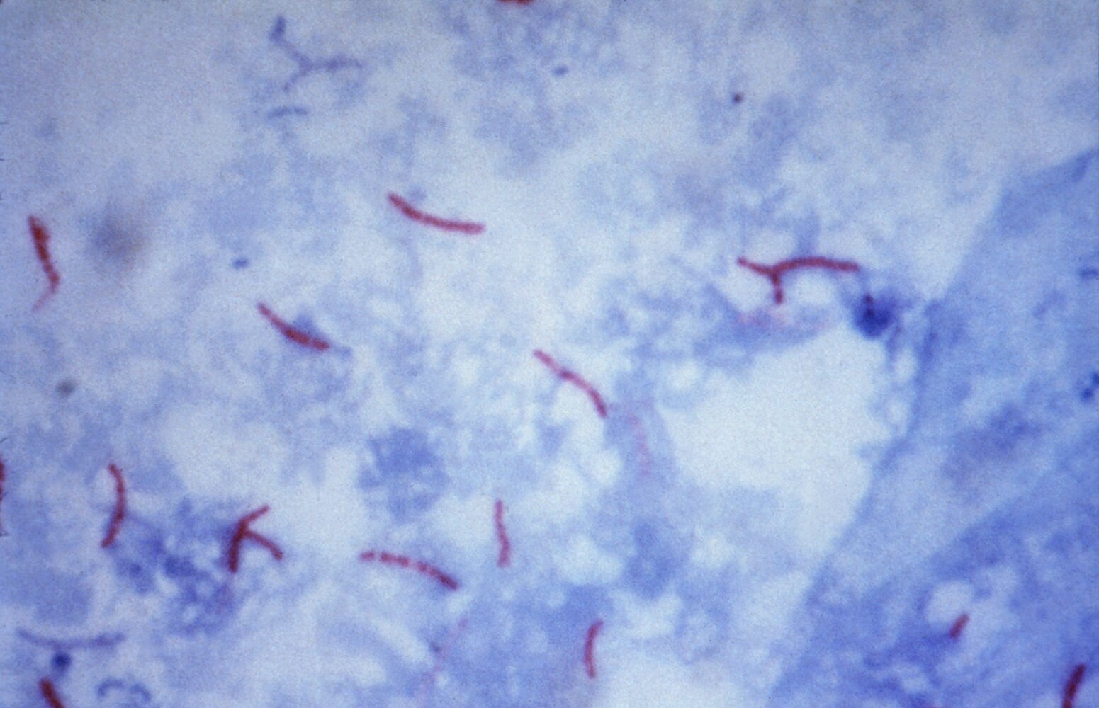 Mycobacterium tuberculosis