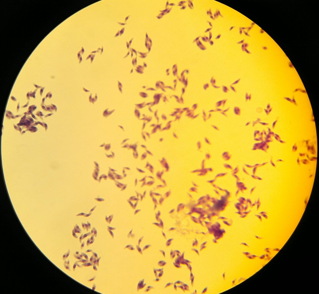 Toxoplasma gondii tachyzoites