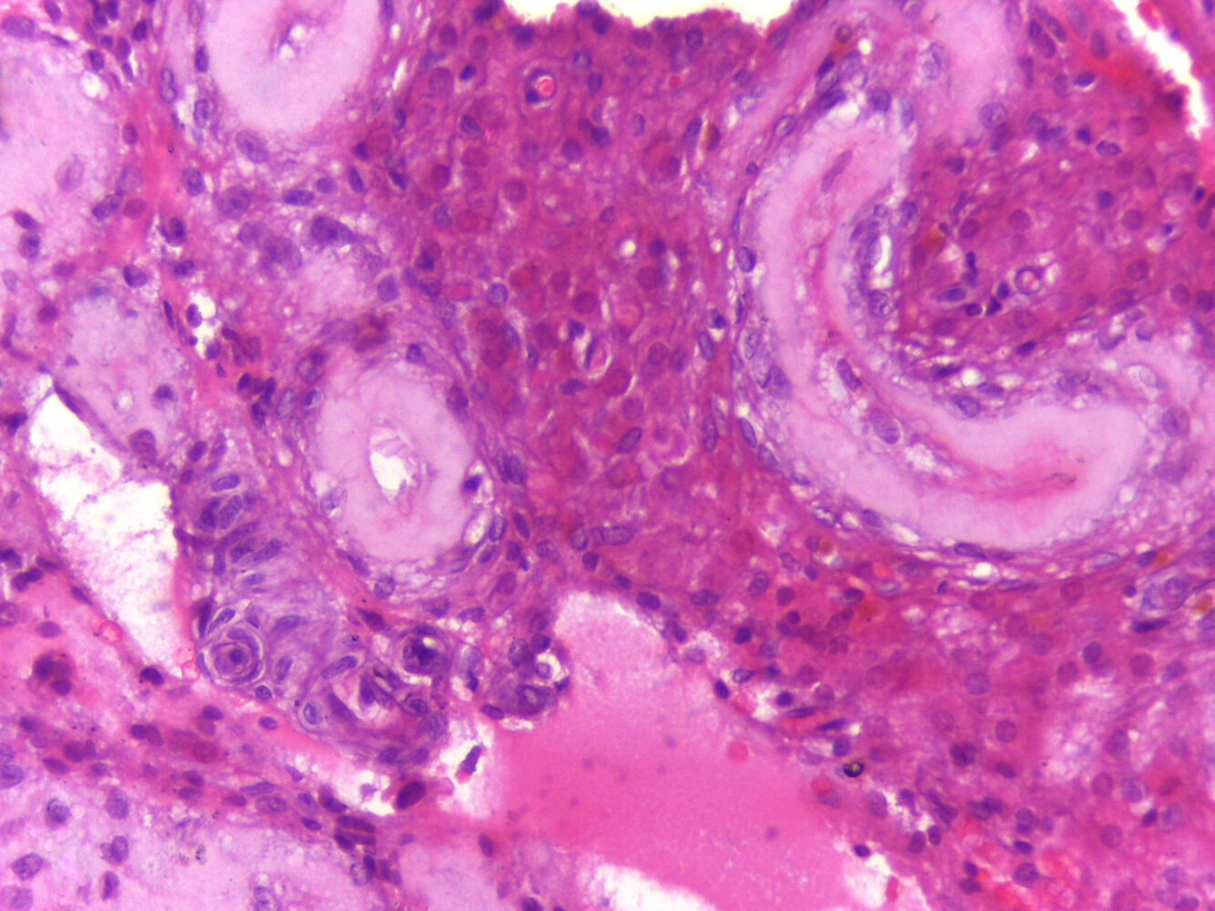 Testis in Klinefelter syndrome