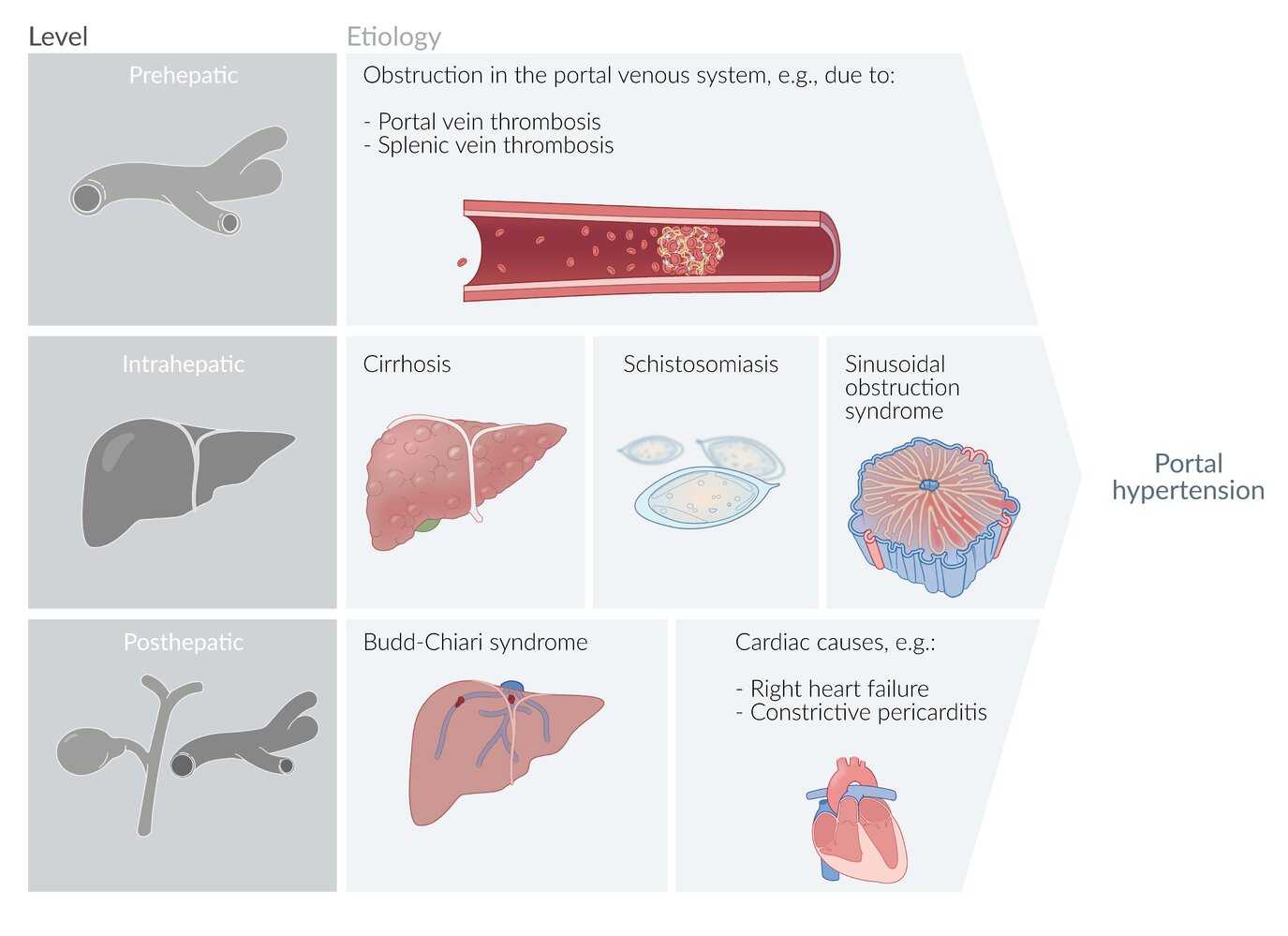 Etiology of portal hypertension