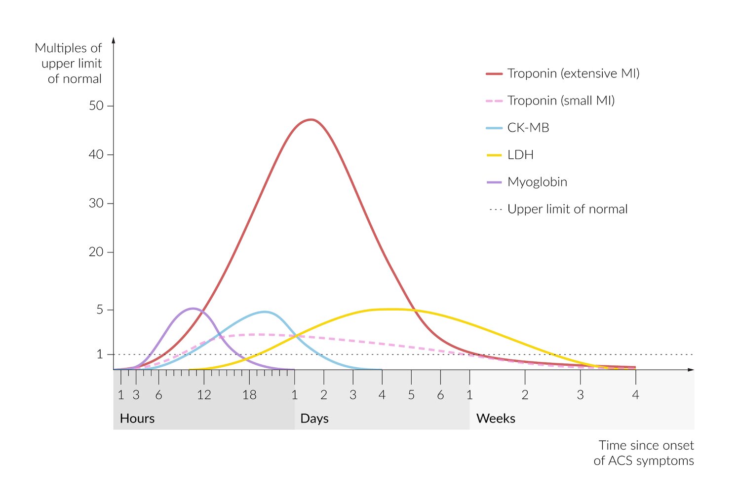 Cardiac enzymes and biomarkers in myocardial infarction