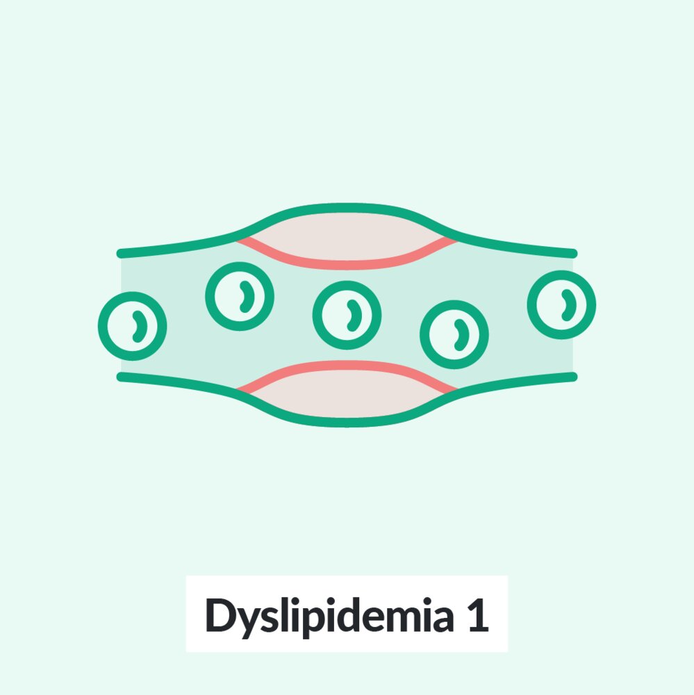 Chalk Talk: Dyslipidemia 1