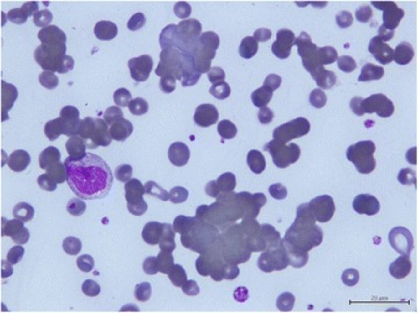 Agglutination of erythrocytes