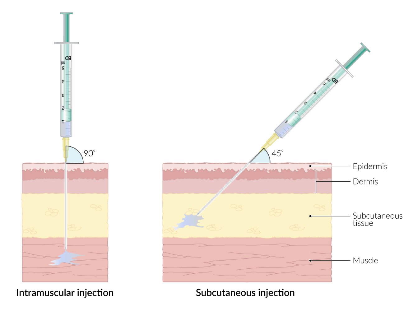 Comparison of intramuscular (IM) and subcutaneous (SC) injection