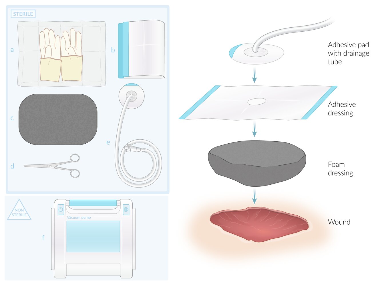 Negative pressure (vacuum-assisted) wound therapy: materials and application
