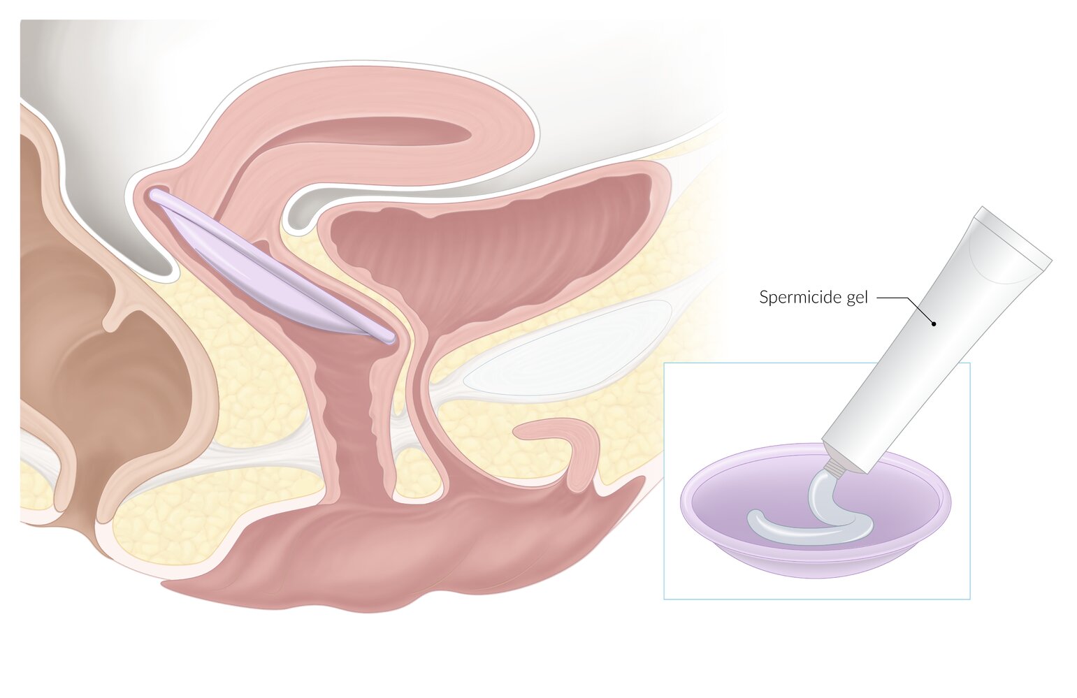 Contraceptive diaphragm