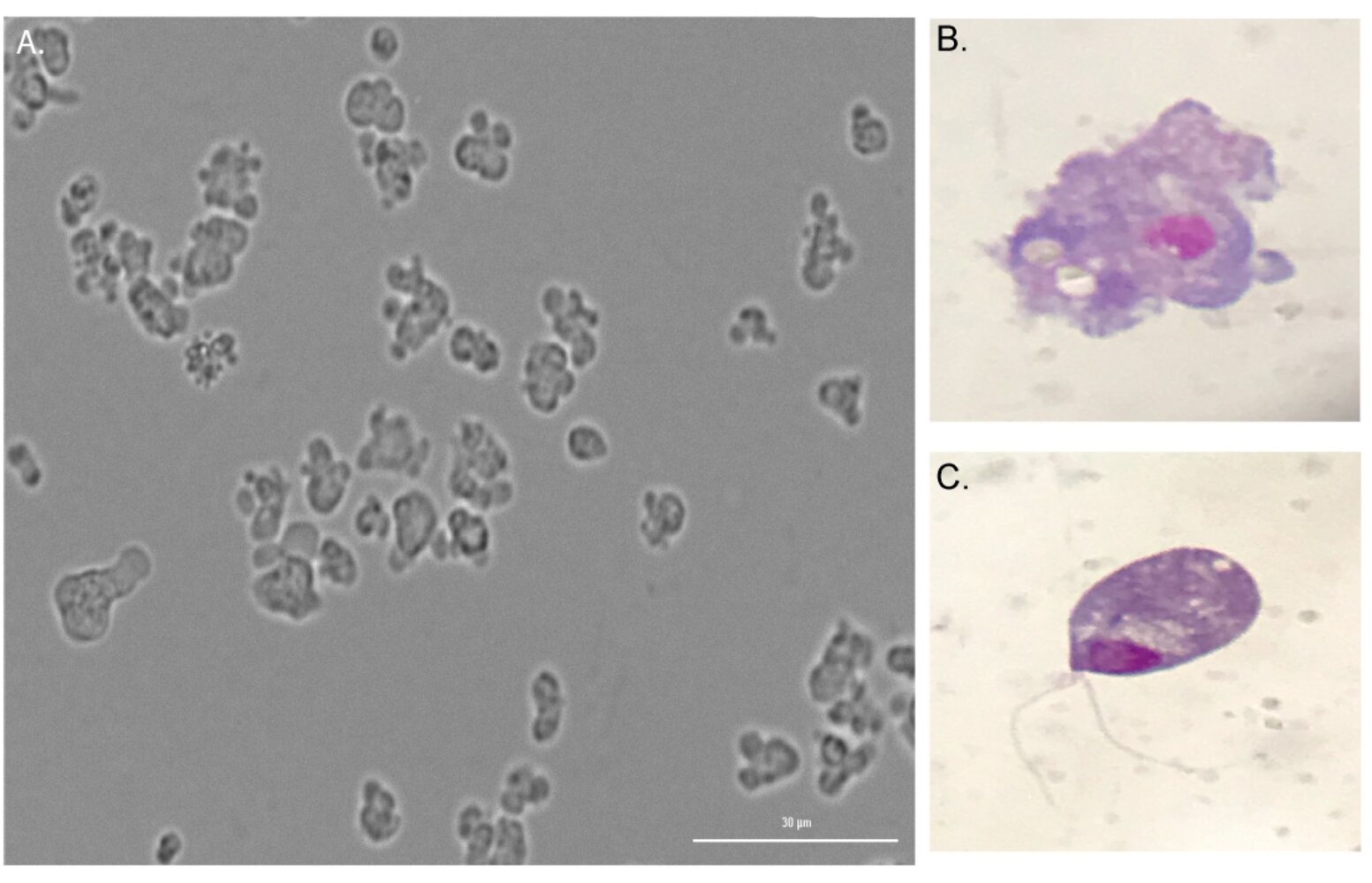 Naegleria fowleri