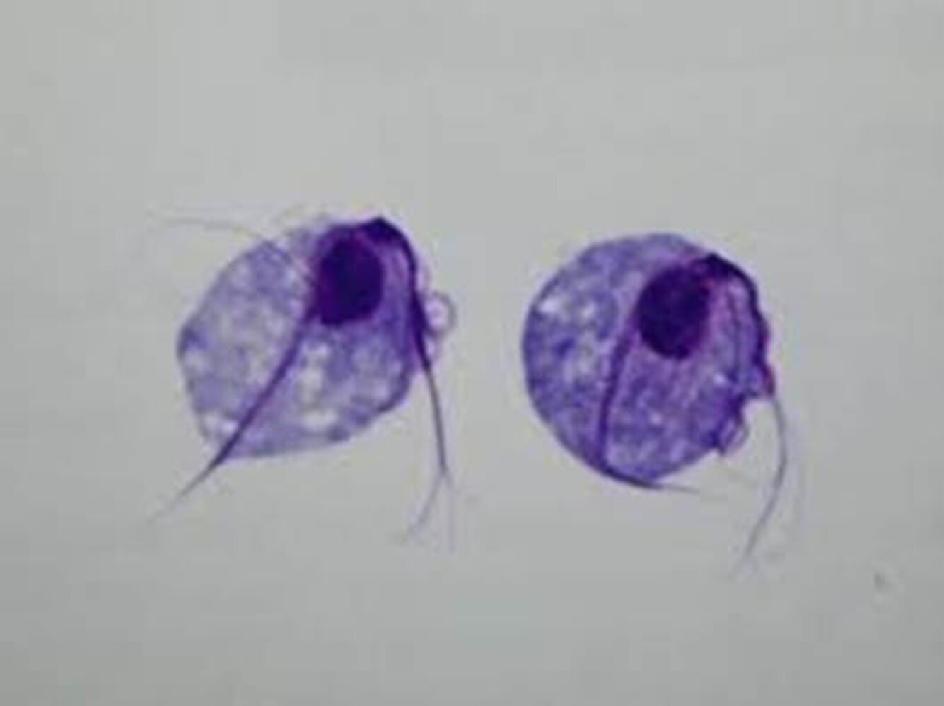 Trichomonas vaginalis