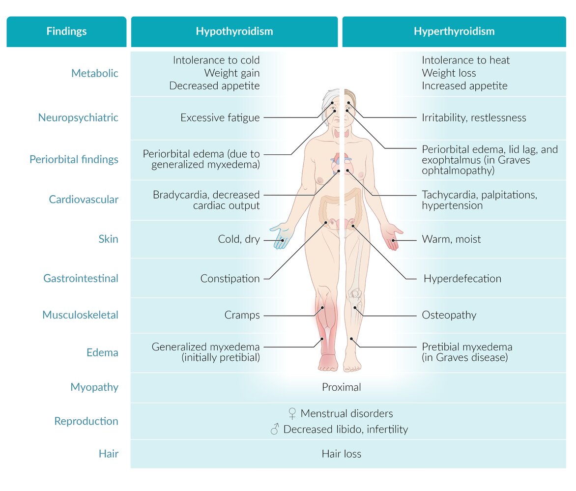 Hypothyroidism and hyperthyroidism fact sheet