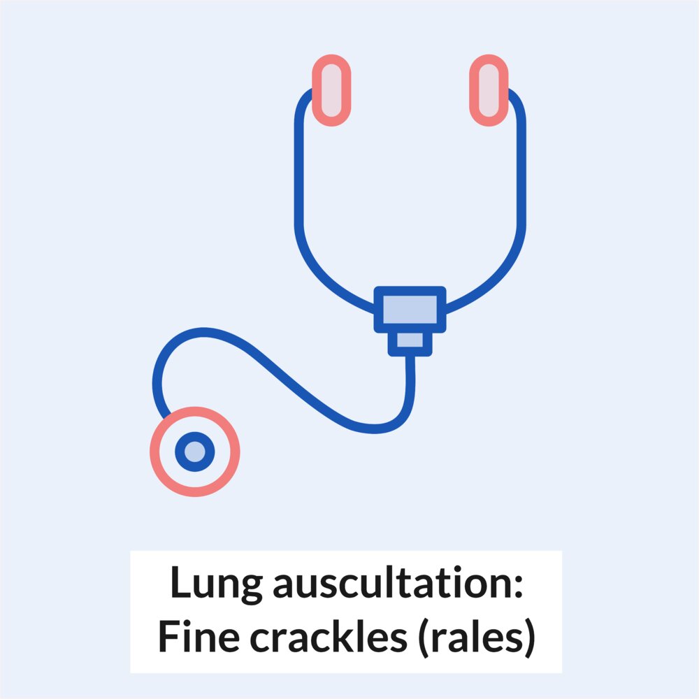 Animation: Lung auscultation - Fine crackles (rales)