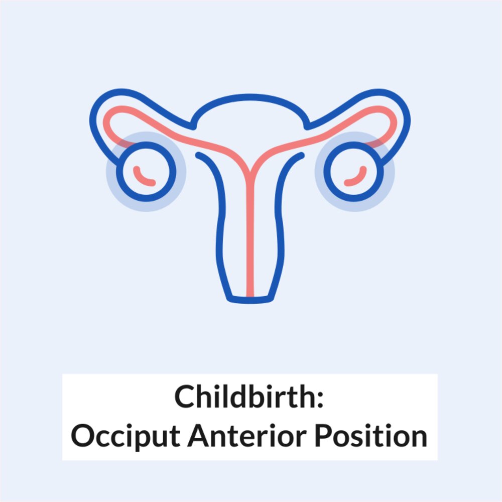 Animation: Childbirth - Occiput Anterior Position
