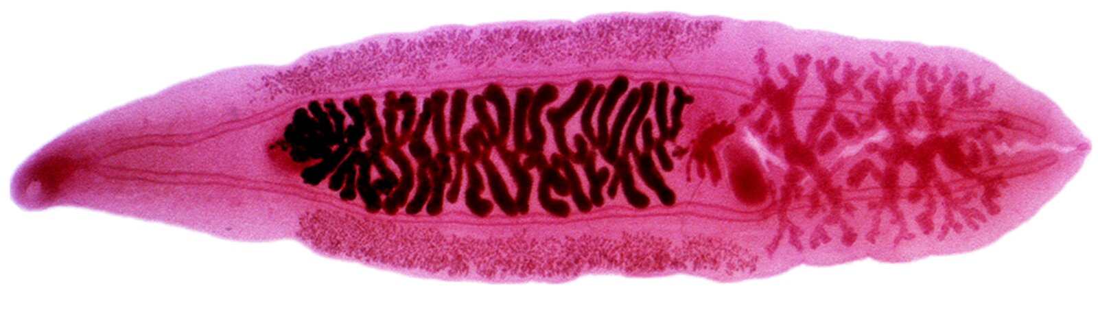 Adult Clonorchis sinensis