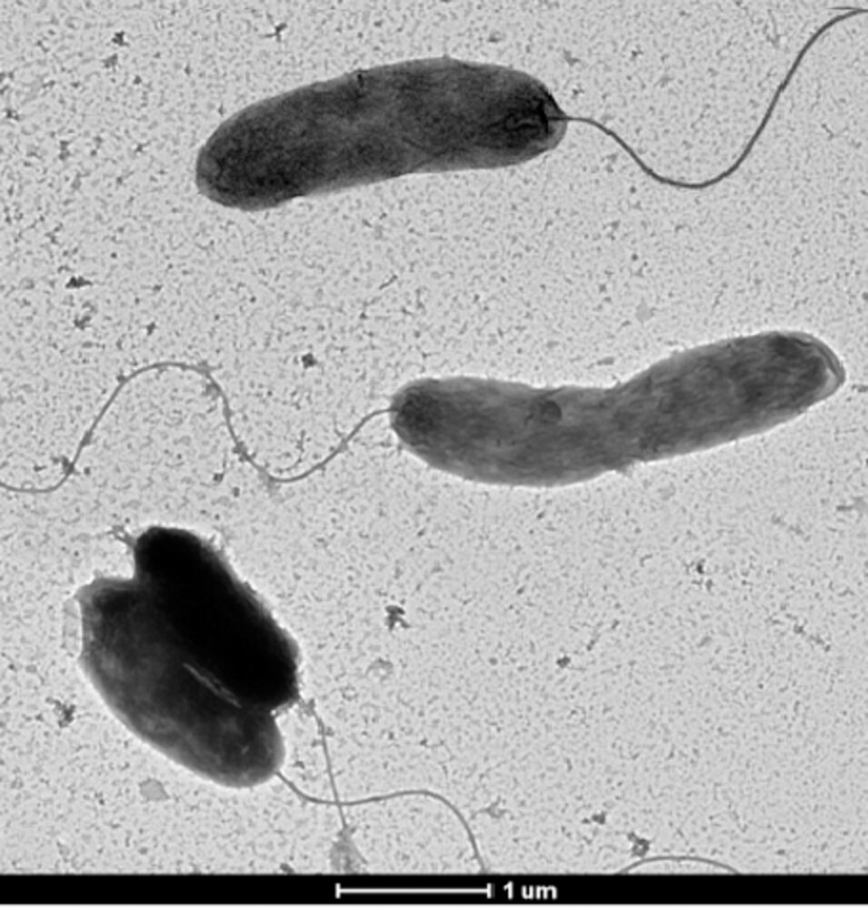 Vibrio cholerae