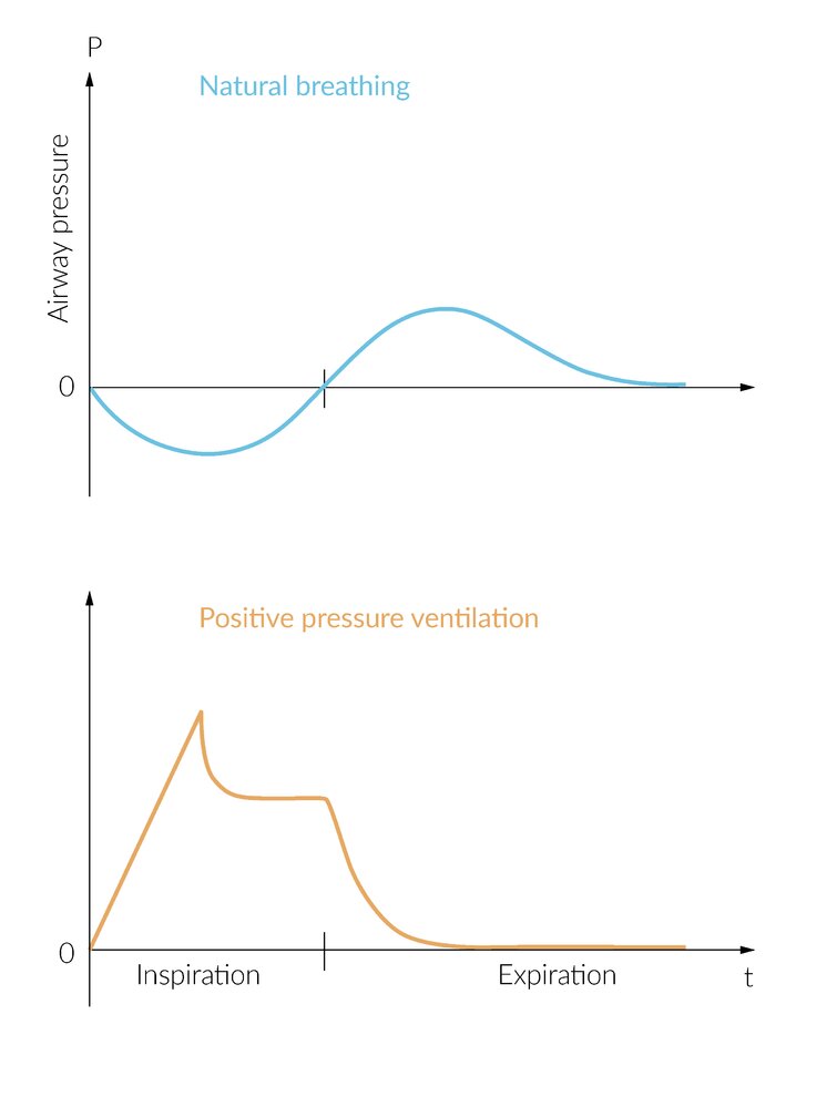 Airway pressure in spontaneous breathing and mechanical ventilation