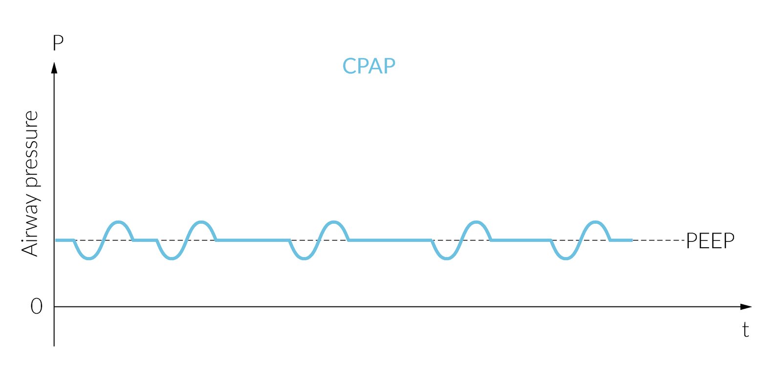 Continuous Positive Airway Pressure (CPAP)
