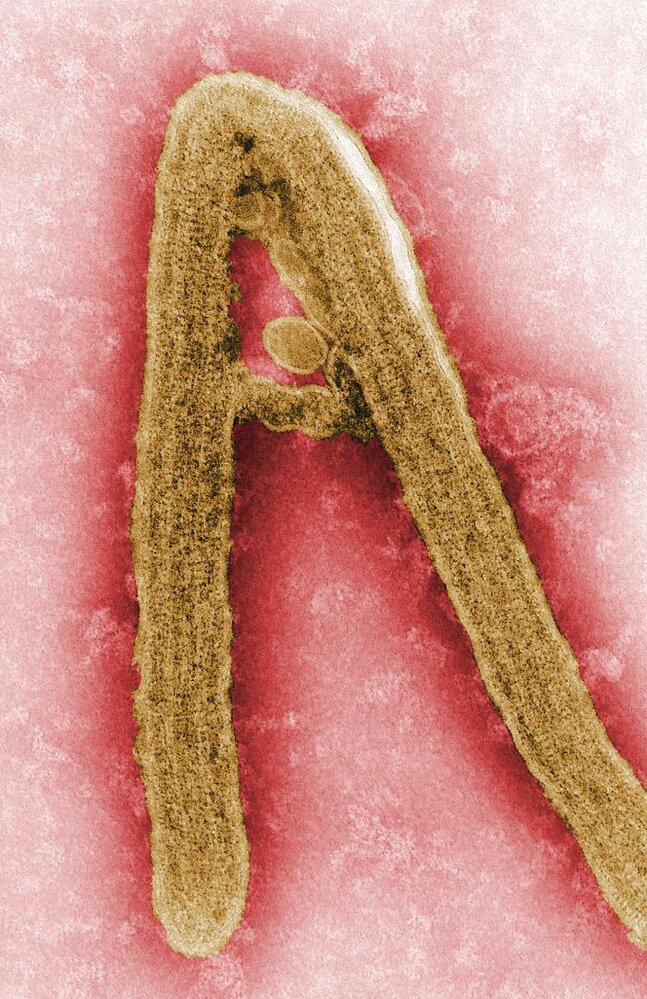 Marburg virus