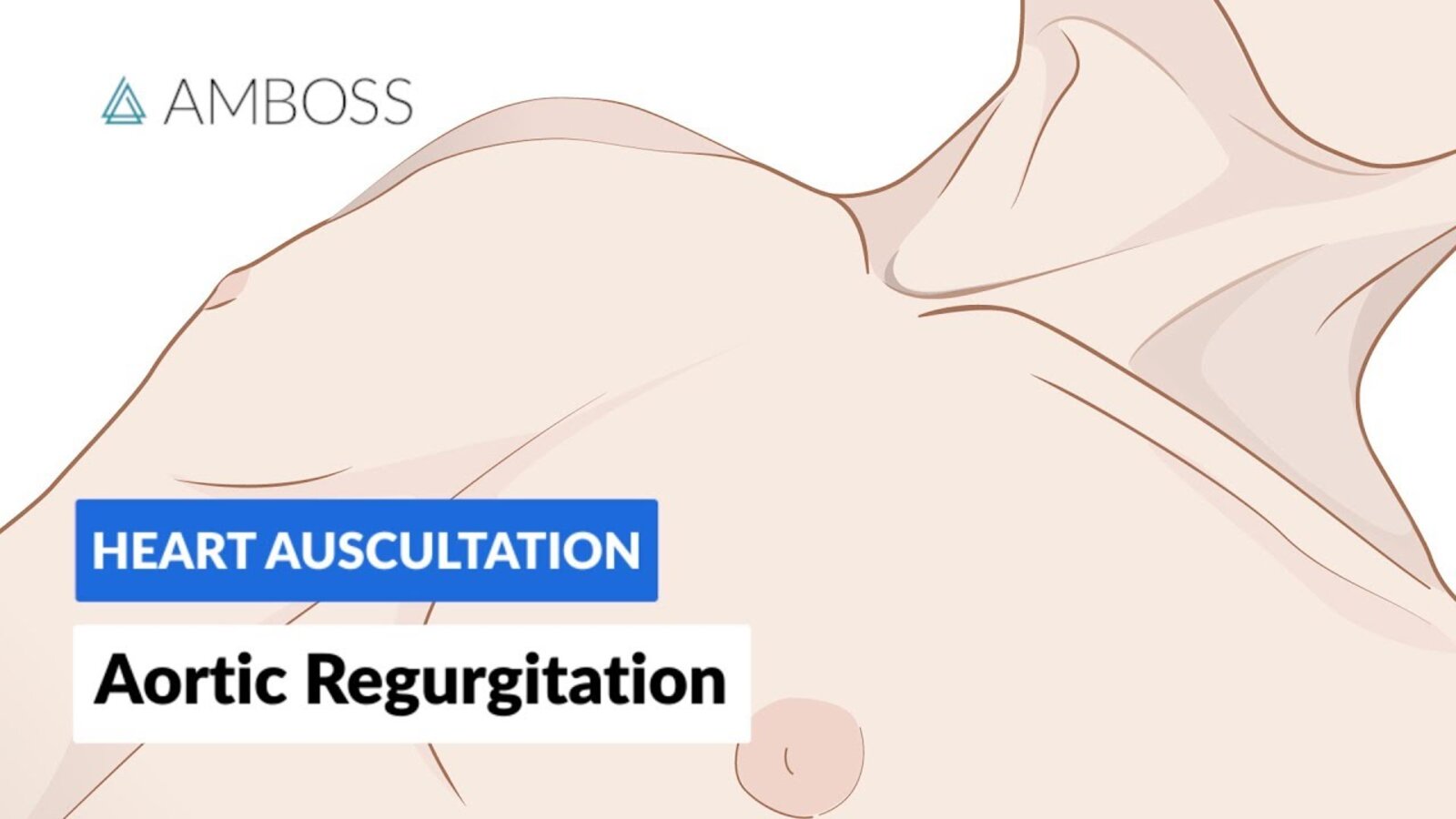 Aortic Regurgitation (AR) - Heart Auscultation - Episode 2