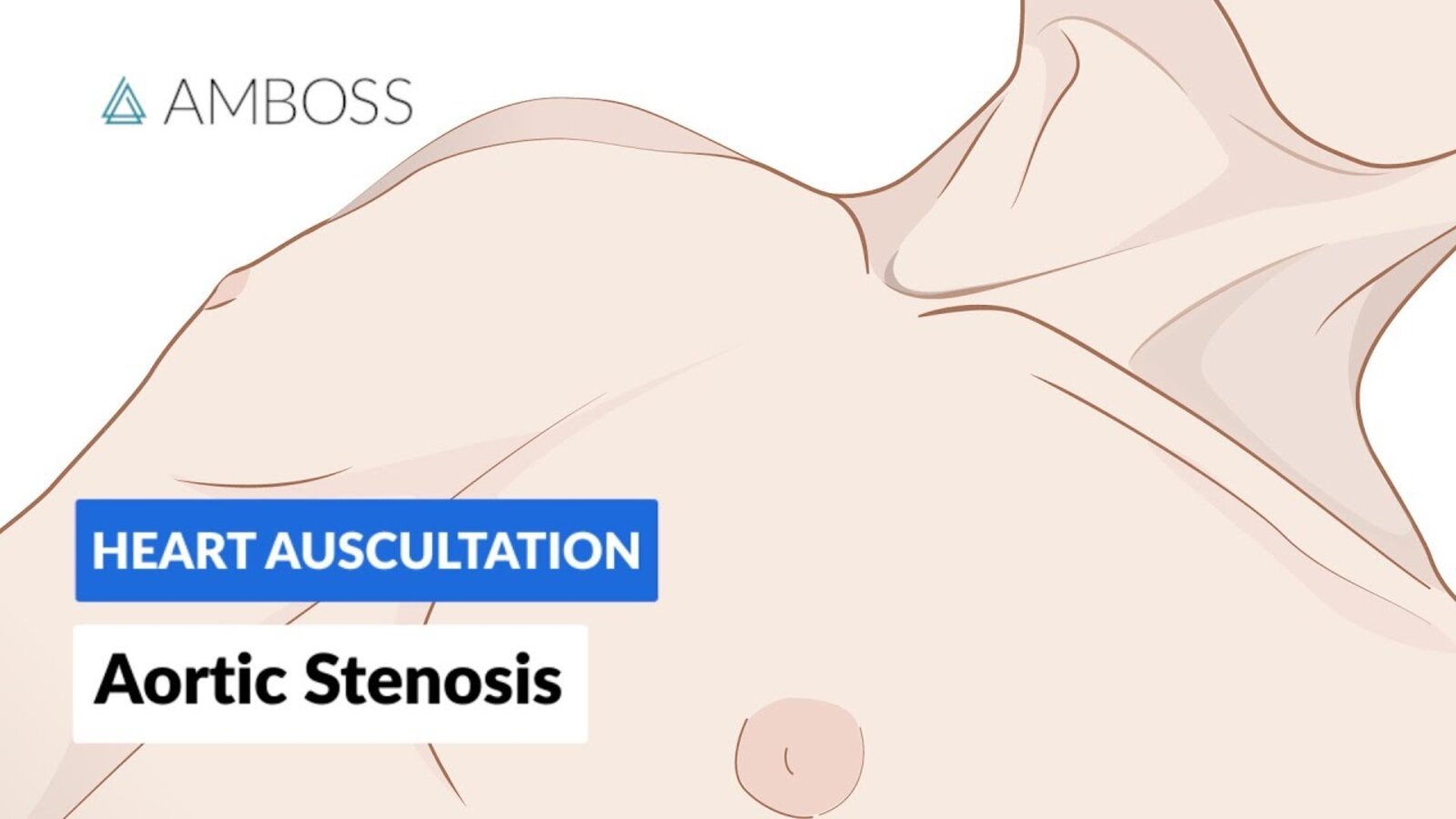 Aortic Stenosis (AS) - Heart Auscultation - Episode 1